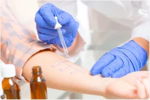 Allergy Testing