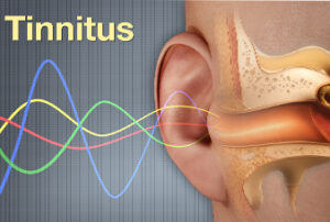 Tinnitus Assessment
